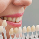 Illustration for article titled Whitening Toothpastes